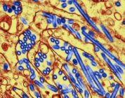 The Last of Us science adviser: COVID changed our appetite for zombies – Nature